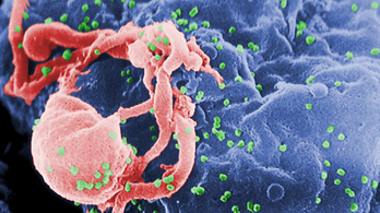 Durván terjed a HIV-vírus Oroszországban, a kormányt hibáztatják