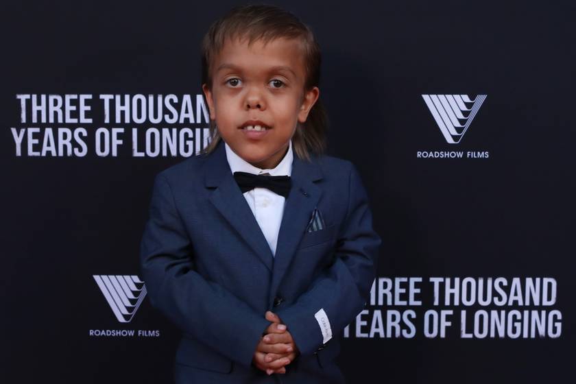 A sokat bántott, törpe növésű kisfiú videója bejárta a világot - Most világsztárokkal szerepel egy filmben