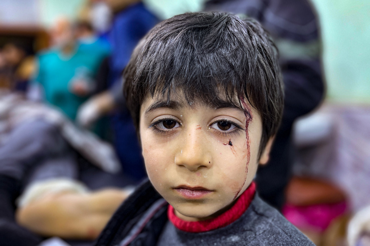 Egy sérült gyermek várja az ellátást Idleb tartományban, Szíriában 2023. február 6-án