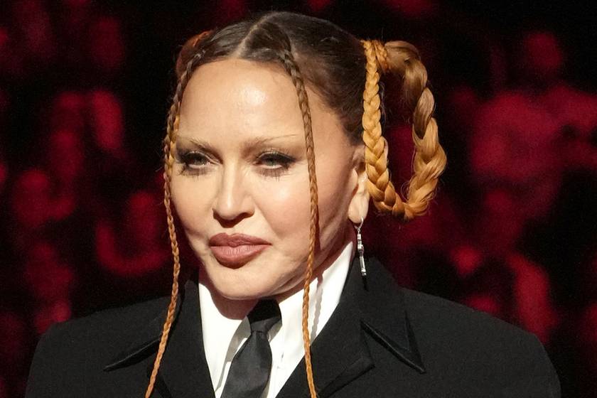 Madonna meglepő okot adott arra, miért nézett ki felismerhetetlenül a Grammy-gálás fotóin