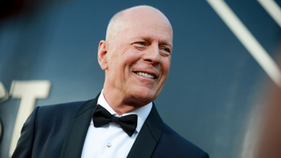 Bruce Willis állapota rosszabbodott