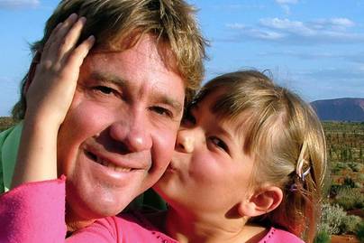 Steve Irwin 24 éves lányát súlyos betegsége miatt műtötték meg: egyik orvosa nem bízott a gyógyulásában