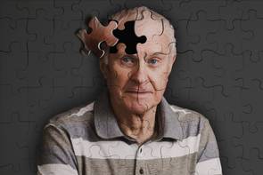 Alzheimer-kór: ha így alszol, te és a partnered is veszélyben van