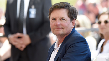 Michael J. Fox több csontja is eltört a betegsége miatt