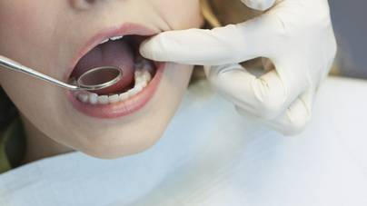 A szájban lévő baktériumok halált is okozhatnak – a rossz lehelet is lehet tünet