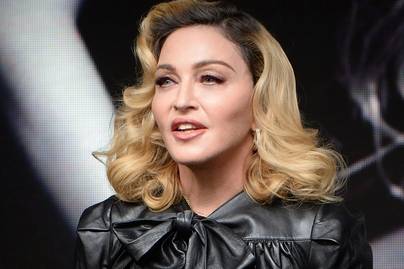 Madonna így festett utolsó fotóin, mielőtt eszméletlenül találtak rá
