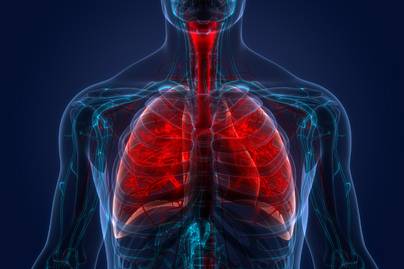 Nem mindegy, mit eszik az ember ilyen tüdőbetegség mellett: az idiopátiás tüdőfibrózis az egész szervezetre veszélyes
