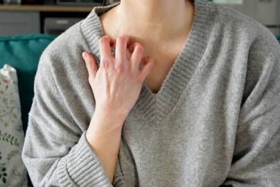 A 4 óriási tévhit a pikkelysömörrel kapcsolatban - Nem csupán egy bőrbetegség
