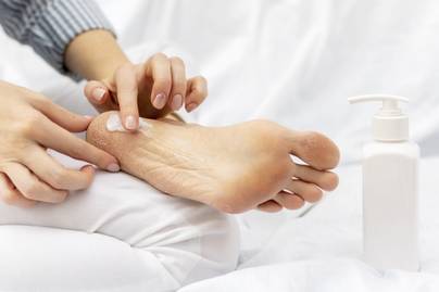 A pajzsmirigyzavar 4 meglepő tünete a lábakon: sokan nem veszik komolyan a jeleit