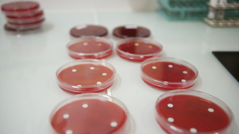 Olyan fertőzések indultak terjedésnek, amelyek ellen az antibiotikum sem véd