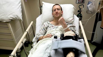 Súlyos sérülést szenvedett Mark Zuckerberg