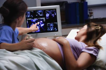 El sem akarták hinni, amit az ultrahangon láttak: nagyon különös dolgot mutatott a baba