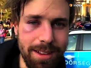 Miért hagyta a rendőrség, hogy betörjék a videóriporter orrát?
