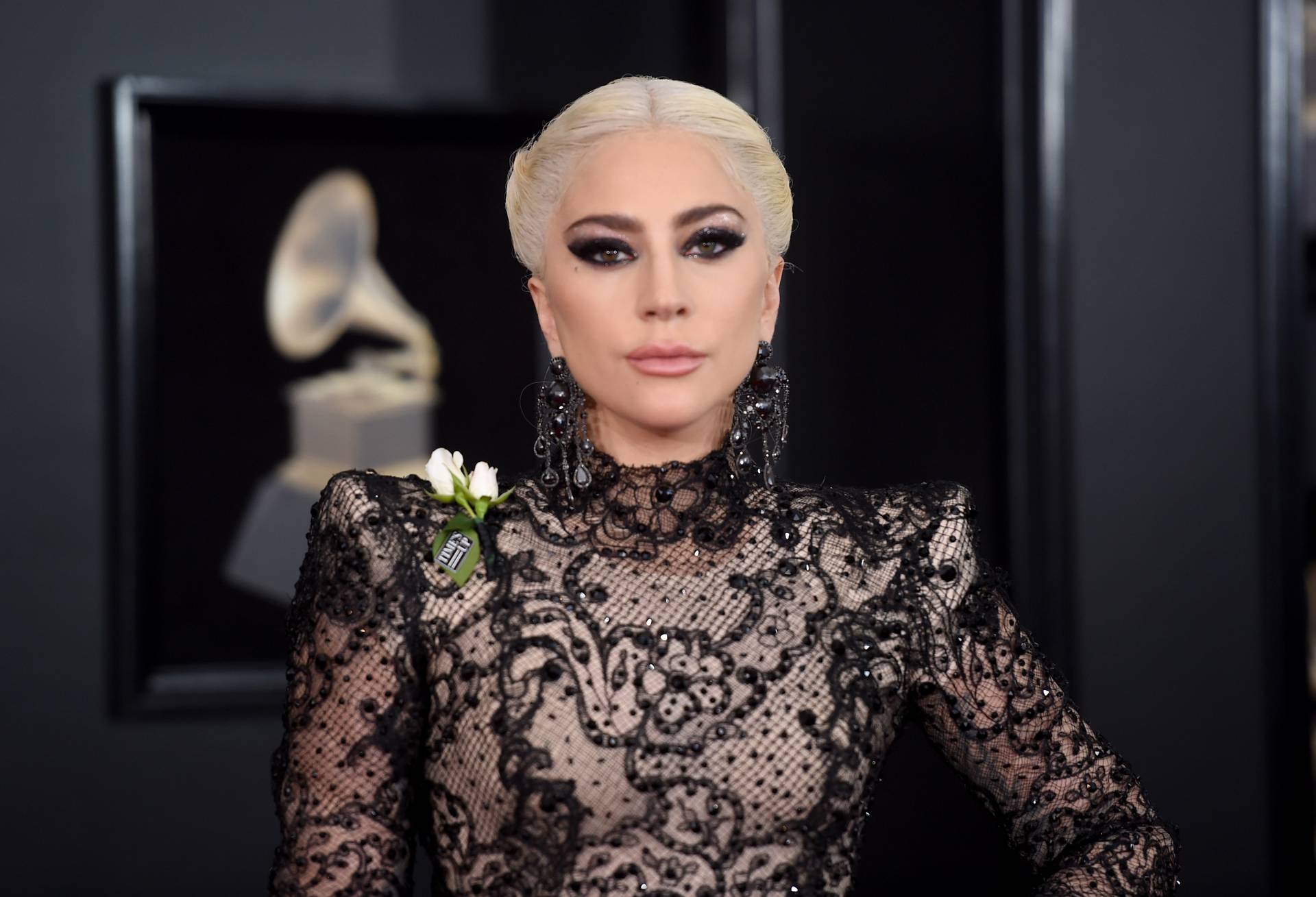 Lady Gaga túltolta a botoxot rajongói szerint: friss fotója kicsapta a biztosítékot