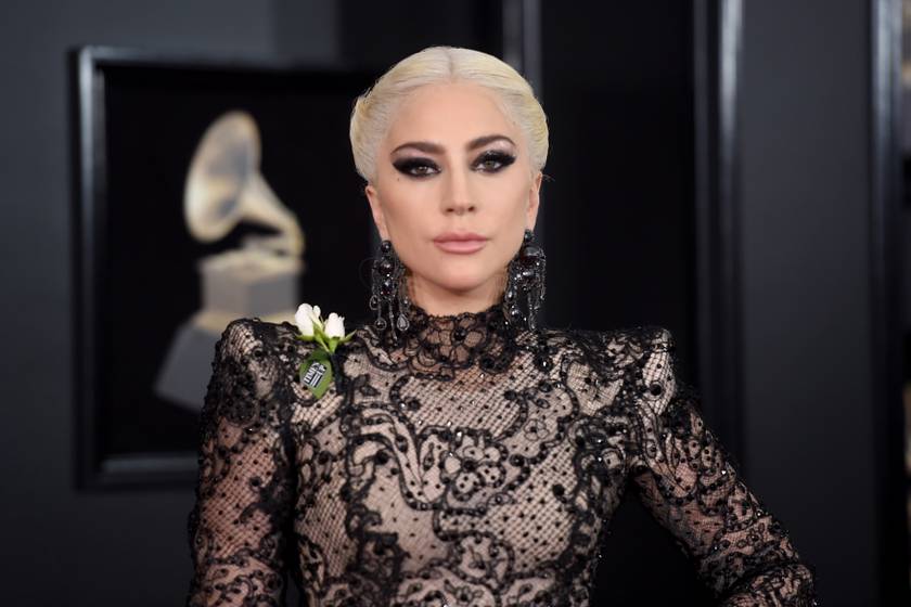 Lady Gaga túltolta a botoxot rajongói szerint: friss fotója kicsapta a biztosítékot