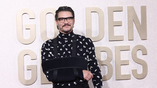 Pedro Pascal összetörte magát, mégis megjelent a Golden Globe-on