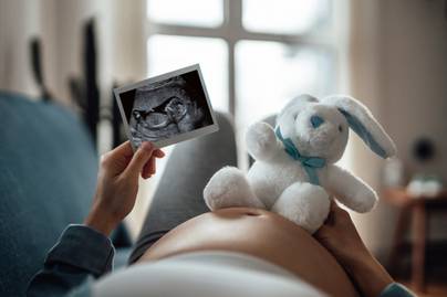 Alig hitték, amit az ultrahangon láttak: különös dolgot mutatott a baba