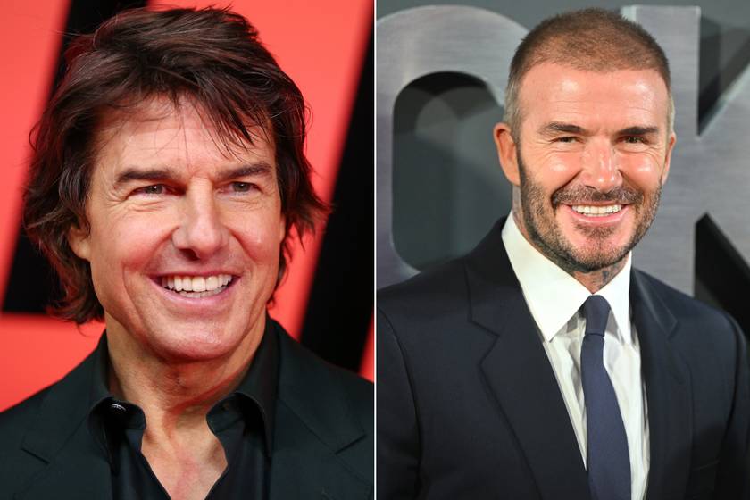 Így nézett ki Tom Cruise, mielőtt megcsináltatta fogait - 8 sztár, akinek teljesen megváltozott a mosolya az évek alatt