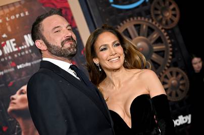 Jennifer Lopez és Ben Affleck plasztikáztattak: ezt csináltatták meg magukon a szakértő szerint