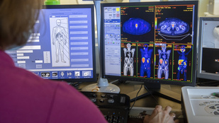 Elhalasztja a kormány a CT- és MRI-vizsgálatok államosítását