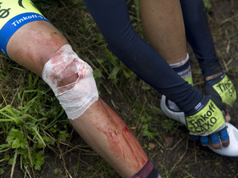 Contador ostoba balesetben törte a lábát