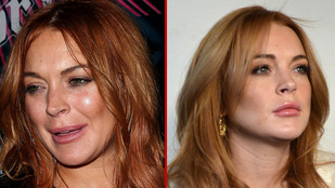Lindsay Lohan két arca ijesztően más
