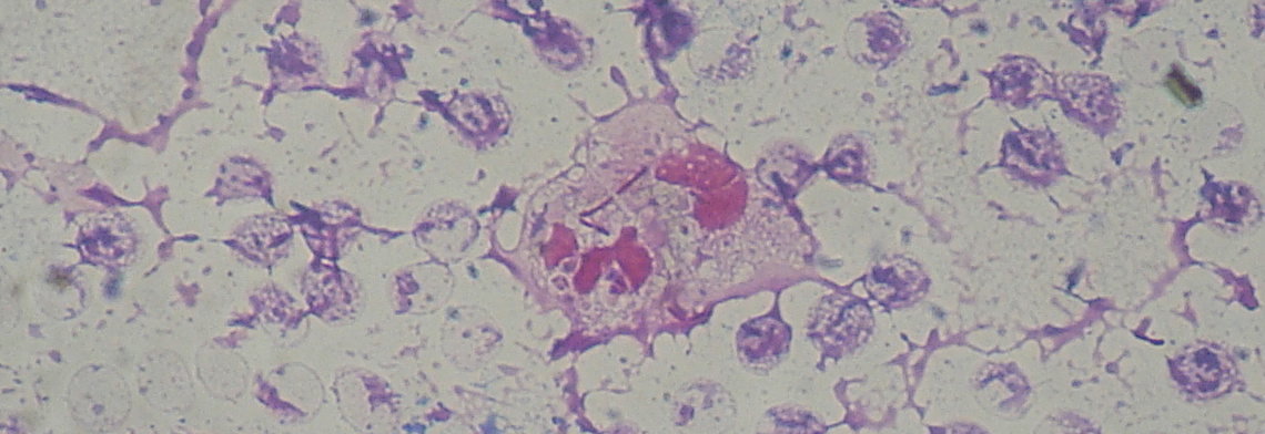 Pseudomonas aeruginosa smear Gram 2010-02-10