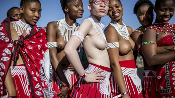 Hipszteresedik a dél-afrikai fotóskedvenc albinó