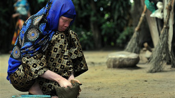 Továbbra is megcsonkítják és gyilkolják a tanzániai albínókat