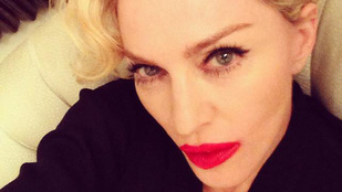 Madonna túlrúzsozta a száját, mint egy szenilis vénasszony