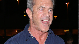 Ilyen Mel Gibson kopaszodó feje