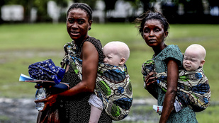 Állatként vágják le a tanzániai albínókat