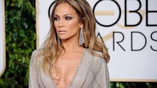 Kutyaharapás miatt perlik Jennifer Lopezt