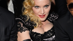 Madonna inhalálással készül, és kivasalták az arcát