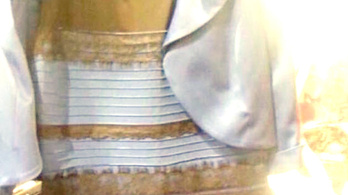 Fehér és arany színűnek látja ezt a ruhát? Valami nem stimmel az agyában