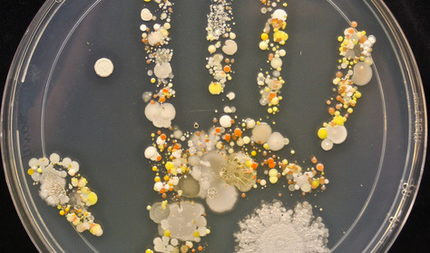 Ilyen baktériumtenyészet lesz a gyerek kezén, ha játszik