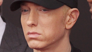 Mégis mi történt Eminem arcával?!